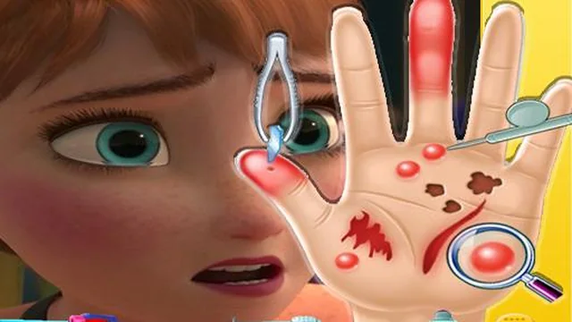 Anna frozen Hand Doctor: Fun Games for Girls Onlin