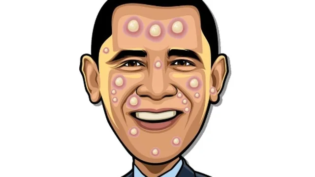 Celebrity Pimple Pop