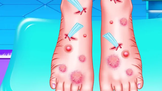 EMMA FOOT TREATMENT