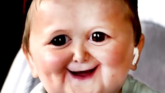 Funny Hasbulla Face