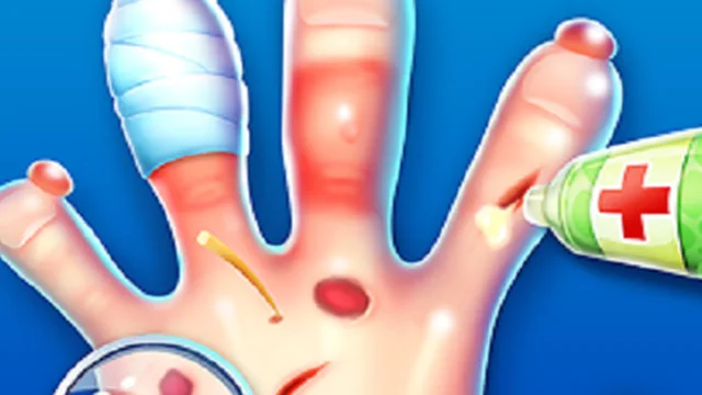 Hand Doctor Game