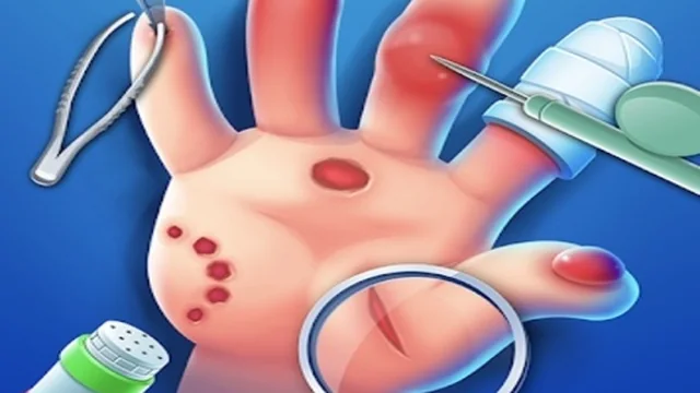 Hand Doctor : Kids Doctor