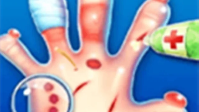 Hand Doctor - Surgery Game For Kids