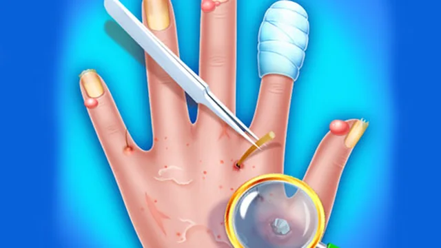 Hand Skin Doctor - Hospital Game