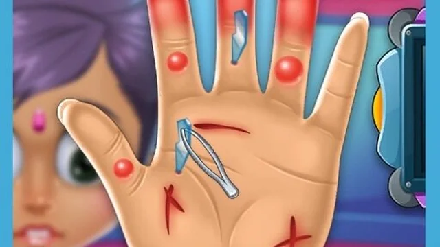 Hand Surgery Doctor Care Game!