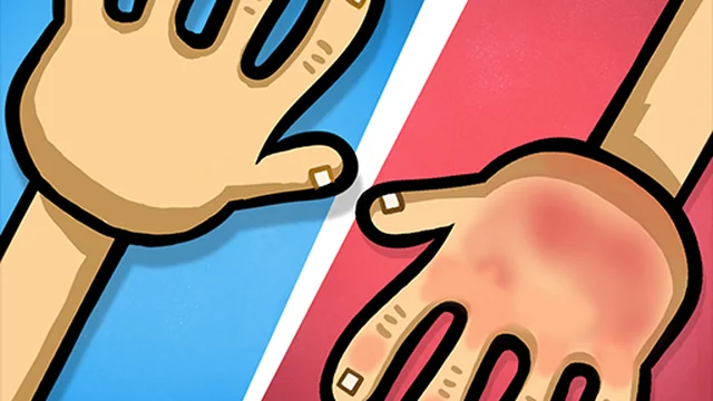 Red Hands 2