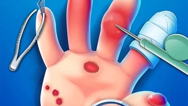 Smart Hand Doctor
